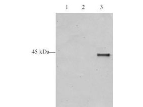 ING5 Antibody - Anti-p28 ING5 Antibody - Western Blot. Western blot analysis is shown using Affinity Purified anti-p28 ING5 antibody to detect over expressed Human ING5 present in HeLa cell nuclear extracts. This western blot shows reactivity with purified recombinant TAP tagged human ING5 protein (lane 3) and does not recognize TAP tagged ING4 on the same membrane (lane 2). A mock purification is shown in lane 1. Comparison to a molecular weight marker (not shown) indicates a single band of ~45.0 kD corresponding to the expected molecular weight for the recombinant protein. The blot was incubated with a 1:500 dilution of the antibody at room temperature followed by detection using chemiluminescence reagent with a 5-min exposure time. Other detection systems will yield similar results. Personal communication Jacques Cote.