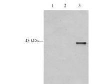 ING5 Antibody - Anti-p28 ING5 Antibody - Western Blot. Western blot analysis is shown using Affinity Purified anti-p28 ING5 antibody to detect over expressed Human ING5 present in HeLa cell nuclear extracts. This western blot shows reactivity with purified recombinant TAP tagged human ING5 protein (lane 3) and does not recognize TAP tagged ING4 on the same membrane (lane 2). A mock purification is shown in lane 1. Comparison to a molecular weight marker (not shown) indicates a single band of ~45.0 kD corresponding to the expected molecular weight for the recombinant protein. The blot was incubated with a 1:500 dilution of the antibody at room temperature followed by detection using chemiluminescence reagent with a 5-min exposure time. Other detection systems will yield similar results. Personal communication Jacques Cote.
