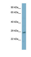 ING5 Antibody - ING5 antibody Western blot of OVCAR-3 cell lysate. This image was taken for the unconjugated form of this product. Other forms have not been tested.