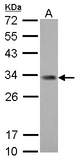 ING5 Antibody - ING5 antibody [N2C1], Internal detects ING5 protein by Western blot analysis. A. 30 ug Jurkat whole cell lysate/extract. 12 % SDS-PAGE. ING5 antibody [N2C1], Internal dilution:1:1000