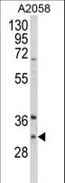 ING5 Antibody - Western blot of ING5 Antibody in A2058 cell line lysates (35 ug/lane). ING5 (arrow) was detected using the purified antibody.
