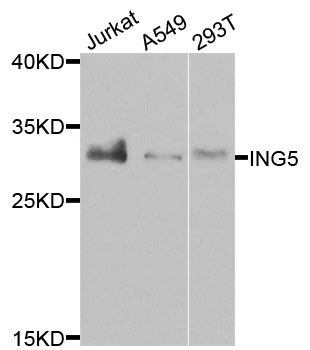 ING5 Antibody - Western blot analysis of extracts of various cells.