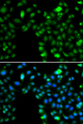ING5 Antibody - Immunofluorescence analysis of MCF7 cells.