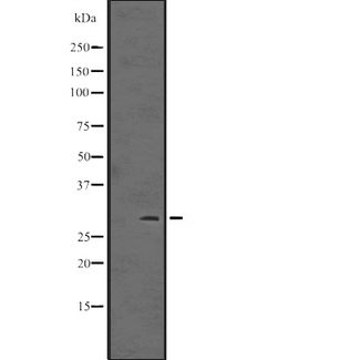 ING5 Antibody - Western blot analysis of ING5 expression in HepG2 whole cells lysate. The lane on the left is treated with the antigen-specific peptide.