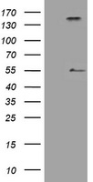 INHA / Inhibin Alpha Antibody - HEK293T cells were transfected with the pCMV6-ENTRY control (Left lane) or pCMV6-ENTRY INHA (Right lane) cDNA for 48 hrs and lysed. Equivalent amounts of cell lysates (5 ug per lane) were separated by SDS-PAGE and immunoblotted with anti-INHA.