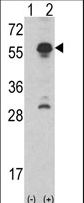 INHA / Inhibin Alpha Antibody - Western blot of INHA(arrow) using rabbit polyclonal INHA Antibody. 293 cell lysates (2 ug/lane) either nontransfected (Lane 1) or transiently transfected with the INHA gene (Lane 2) (Origene Technologies).