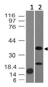 INHA / Inhibin Alpha Antibody - Fig-1: Western blot analysis of Inhibin Alpha. Anti-Inhibin Alpha antibody was tested at 0.5 µg/ml on Recombinant and human Ovary lysates.