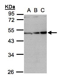 INHBA / Inhibin Beta A Antibody - Sample (30 ug whole cell lysate). A: H1299, B: HeLa S3, C: Hep G2 . 10% SDS PAGE. Inhibin Beta A / INHBA antibody diluted at 1:1000