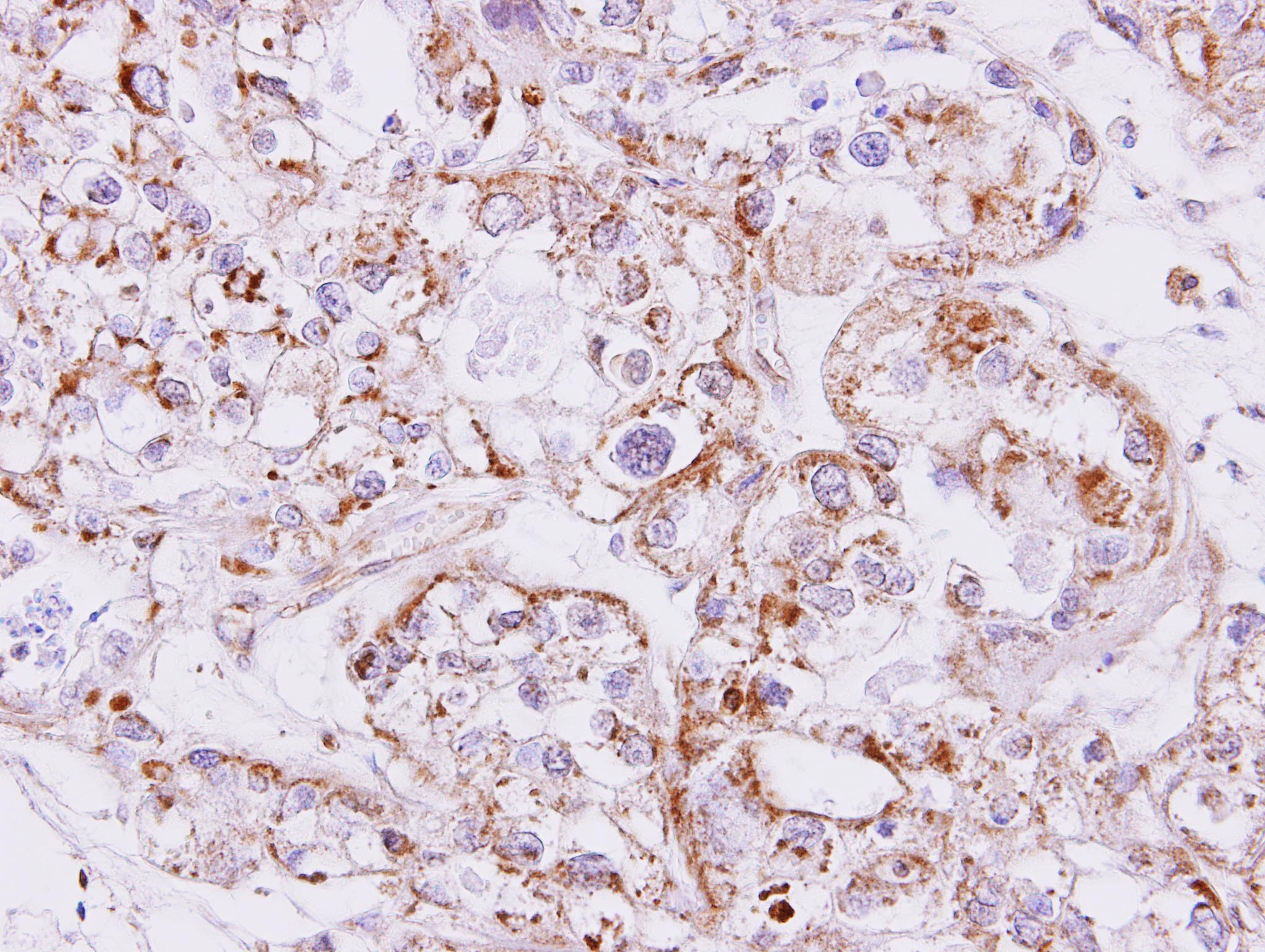 Anti-INHBA / Inhibin Beta A Antibody | Rabbit anti-Human ICC,IHC,WB | LSBio