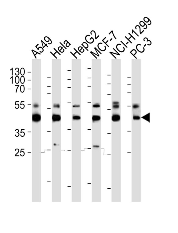 INHBA / Inhibin Beta A Antibody - Western blot of lysates from A549, HeLa, HepG2, MCF-7, NCI-H1299, PC-3 cell line (from left to right) with INHBA Antibody. Antibody was diluted at 1:1000 at each lane. A goat anti-rabbit IgG H&L (HRP) at 1:5000 dilution was used as the secondary antibody. Lysates at 35 ug per lane.