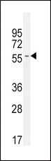 INHBA / Inhibin Beta A Antibody - INHBA Antibody western blot of CEM cell line lysates (35 ug/lane). The INHBA antibody detected the INHBA protein (arrow).
