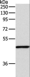 INHBA / Inhibin Beta A Antibody - Western blot analysis of Mouse fat tissue, using INHBA Polyclonal Antibody at dilution of 1:1000.