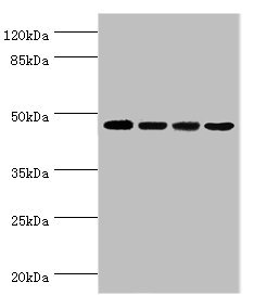 INHBA / Inhibin Beta A Antibody - Western blot All Lanes:Inhibin beta A chain antibody at 2ug/ml Lane 1:Hela whole cell lysate Lane 2:HepG2 whole cell lysate Lane 3:A549 whole cell lysate Lane 4:MCF-7 whole cell lysate Secondary Goat polyclonal to rabbit at 1/10000 dilution Predicted band size: 47kDa Observed band size: 47kDa