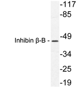 INHBB / Inhibin Beta B Antibody - Western blot analysis of lysate from HeLa cells, using Inhibin Î²-B antibody.