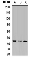 INHBB / Inhibin Beta B Antibody - Western blot analysis of Inhibin beta B expression in HEK293T (A); Raw264.7 (B); H9C2 (C) whole cell lysates.