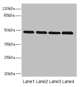 INHBB / Inhibin Beta B Antibody - Western blot All lanes: INHBB antibody at 2µg/ml Lane 1: U87 whole cell lysate Lane 2: A549 whole cell lysate Lane 3: A431 whole cell lysate Lane 4: Hela whole cell lysate Secondary Goat polyclonal to rabbit IgG at 1/10000 dilution Predicted band size: 45 kDa Observed band size: 45 kDa