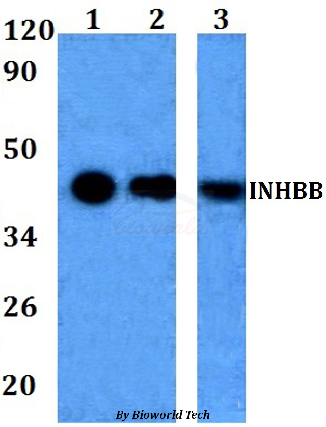 INHBB / Inhibin Beta B Antibody - Western blot of INHBB antibody at 1:500 dilution. Lane 1: HEK293T whole cell lysate. Lane 2: Raw264.7 whole cell lysate. Lane 3: H9C2 whole cell lysate.