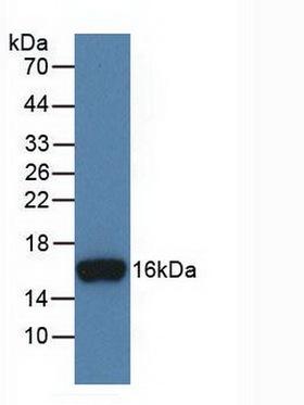 Anti-INHBB / Inhibin Beta B Antibody | Mouse Anti-Human Monoclonal | LSBio