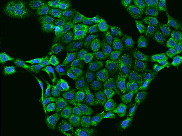 INHBB / Inhibin Beta B Antibody - Immunofluorescence staining of Inhibin beta B in A431 cells. Cells were fixed with 4% PFA, permeabilzed with 0.3% Triton X-100 in PBS, blocked with 10% serum, and incubated with rabbit anti-Human Inhibin beta B polyclonal antibody (dilution ratio 1:200) at 4°C overnight. Then cells were stained with the Alexa Fluor 488-conjugated Goat Anti-rabbit IgG secondary antibody (green) and counterstained with DAPI (blue). Positive staining was localized to Cytoplasm.