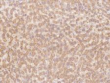 INHBB / Inhibin Beta B Antibody - Immunochemical staining of human Inhibin beta B in human liver with rabbit polyclonal antibody at 1:200 dilution, formalin-fixed paraffin embedded sections.