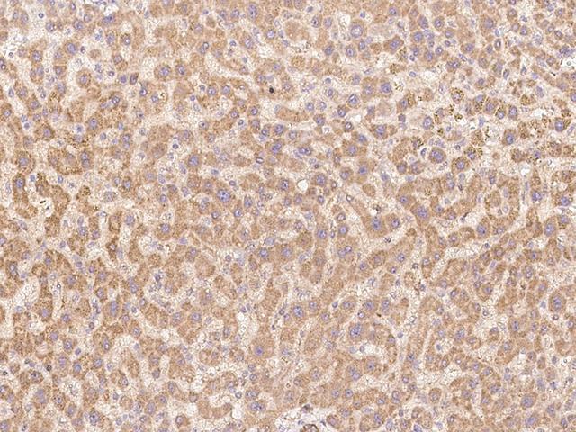 INHBB / Inhibin Beta B Antibody - Immunochemical staining of human Inhibin beta B in human liver with rabbit polyclonal antibody at 1:200 dilution, formalin-fixed paraffin embedded sections.