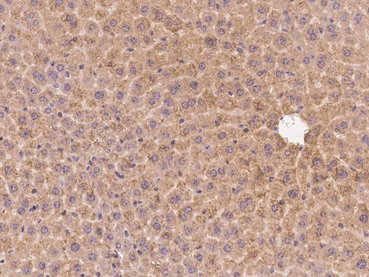 Anti-INHBB / Inhibin Beta B Antibody | Rabbit Anti-Human ICC,IF,IHC | LSBio