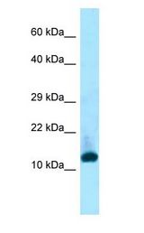 INHBC Antibody - INHBC antibody Western Blot of OVCAR-3 cell lysate. INHBC is supported by BioGPS gene expression data to be expressed in OVCAR3.  This image was taken for the unconjugated form of this product. Other forms have not been tested.