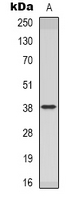 INHBC Antibody - Western blot analysis of Inhibin beta C expression in HeLa (A) whole cell lysates.