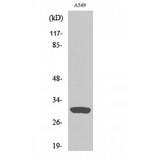 INHBC Antibody - Western blot of Inhibin beta-C antibody