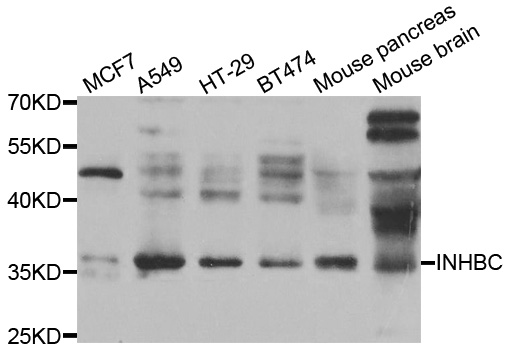 INHBC Antibody - Western blot analysis of extracts of various cell lines.