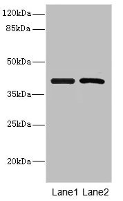 INHBC Antibody - Western blot All Lanes: INHBCantibody at 5.16ug/ml Lane 1 : Hela whole cell lysate Lane 2 : A549 whole cell lysate Secondary Goat polyclonal to Rabbit IgG at 1/10000 dilution Predicted band size: 38 kDa Observed band size: 38 kDa