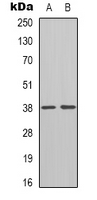 INHBE / Activin Antibody - Western blot analysis of Inhibin beta E expression in L929 (A); rat heart (B) whole cell lysates.