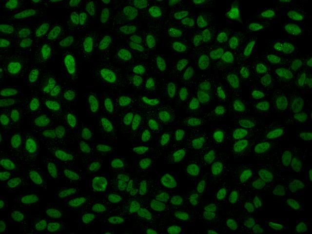 INIP / C9orf80 Antibody - Immunofluorescence staining of C9orf80 in U2OS cells. Cells were fixed with 4% PFA, permeabilzed with 0.1% Triton X-100 in PBS, blocked with 10% serum, and incubated with rabbit anti-Human C9orf80 polyclonal antibody (dilution ratio 1:200) at 4°C overnight. Then cells were stained with the Alexa Fluor 488-conjugated Goat Anti-rabbit IgG secondary antibody (green). Positive staining was localized to Nucleus.