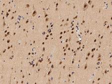 INIP / C9orf80 Antibody - Immunochemical staining of human C9orf80 in human brain with rabbit polyclonal antibody at 1:100 dilution, formalin-fixed paraffin embedded sections.