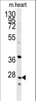 INMT Antibody - INMT Antibody western blot of mouse heart tissue lysates (35 ug/lane). The INMT antibody detected INMT protein (arrow).