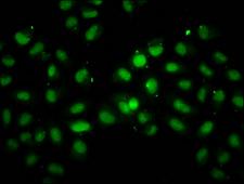 INO80 Antibody - Immunofluorescence staining of Hela cells diluted at 1:100, counter-stained with DAPI. The cells were fixed in 4% formaldehyde, permeabilized using 0.2% Triton X-100 and blocked in 10% normal Goat Serum. The cells were then incubated with the antibody overnight at 4°C.The Secondary antibody was Alexa Fluor 488-congugated AffiniPure Goat Anti-Rabbit IgG (H+L).