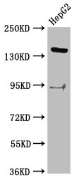 INO80 Antibody - Western Blot Positive WB detected in: HepG2 whole cell lysate All Lanes: INO80 antibody at 2.9µg/ml Secondary Goat polyclonal to rabbit IgG at 1/50000 dilution Predicted band size: 177 KDa Observed band size: 177 KDa