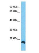INO80C Antibody - INO80C antibody Western Blot of PANC1. Antibody dilution: 1 ug/ml.  This image was taken for the unconjugated form of this product. Other forms have not been tested.