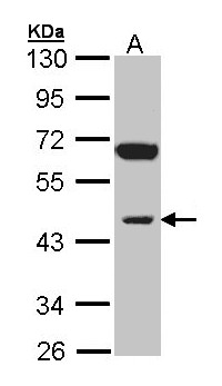 INPP1 Antibody - Sample (30 ug of whole cell lysate). A: Raji. 10% SDS PAGE. INPP1 antibody diluted at 1:1000