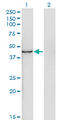 INPP1 Antibody - Western Blot analysis of INPP1 expression in transfected 293T cell line by INPP1 monoclonal antibody (M11), clone 4F9.Lane 1: INPP1 transfected lysate(44 KDa).Lane 2: Non-transfected lysate.