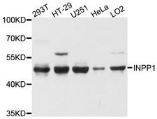 INPP1 Antibody - Western blot analysis of extracts of various cell lines, using INPP1 antibody at 1:1000 dilution. The secondary antibody used was an HRP Goat Anti-Rabbit IgG (H+L) at 1:10000 dilution. Lysates were loaded 25ug per lane and 3% nonfat dry milk in TBST was used for blocking. An ECL Kit was used for detection and the exposure time was 10s.