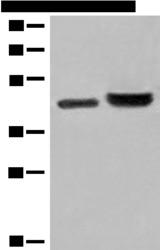 INPP1 Antibody - Western blot analysis of 231 cell and Human fetal liver tissue lysates  using INPP1 Polyclonal Antibody at dilution of 1:500
