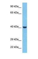 INPP1 Antibody - Western blot of INPP Antibody with human MCF7 Whole Cell lysate.  This image was taken for the unconjugated form of this product. Other forms have not been tested.
