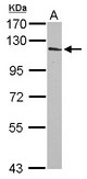 INPP4A Antibody - Sample (30 ug of whole cell lysate) A: NT2D1 7.5% SDS PAGE INPP4A antibody diluted at 1:1000