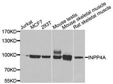 INPP4A Antibody - Western blot analysis of extracts of various cells.