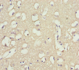 INPP4A Antibody - Immunohistochemistry of paraffin-embedded human brain tissue at dilution 1:100
