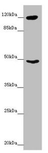 INPP4A Antibody - Western blot All Lanes:INPP4A antibody at 8.79 ug/ml + Mouse brain tissue Secondary Goat polyclonal to rabbit IgG at 1/10000 dilution Predicted band size: 110,106,108 kDa Observed band size: 110,48 kDa