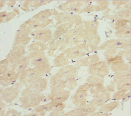 INPP4A Antibody - Immunohistochemistry of paraffin-embedded human heart tissue at dilution 1:100