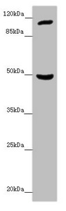 INPP4A Antibody - Western blot All Lanes:INPP4A antibody at 7.06 ug/ml + Mouse brain tissue Secondary Goat polyclonal to rabbit IgG at 1/10000 dilution Predicted band size: 110,106,108 kDa Observed band size: 110,48 kDa