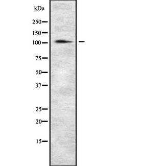 INPP4A Antibody - Western blot analysis of INPP4A using HeLa whole lysates.